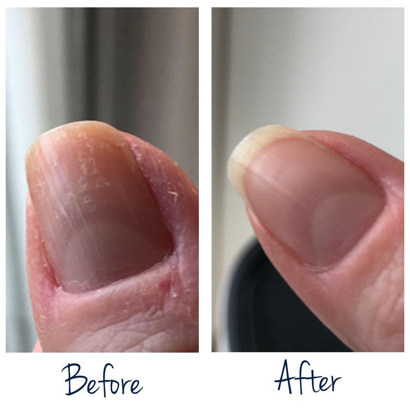 Exit Damaged Nails - Aldo Coppola